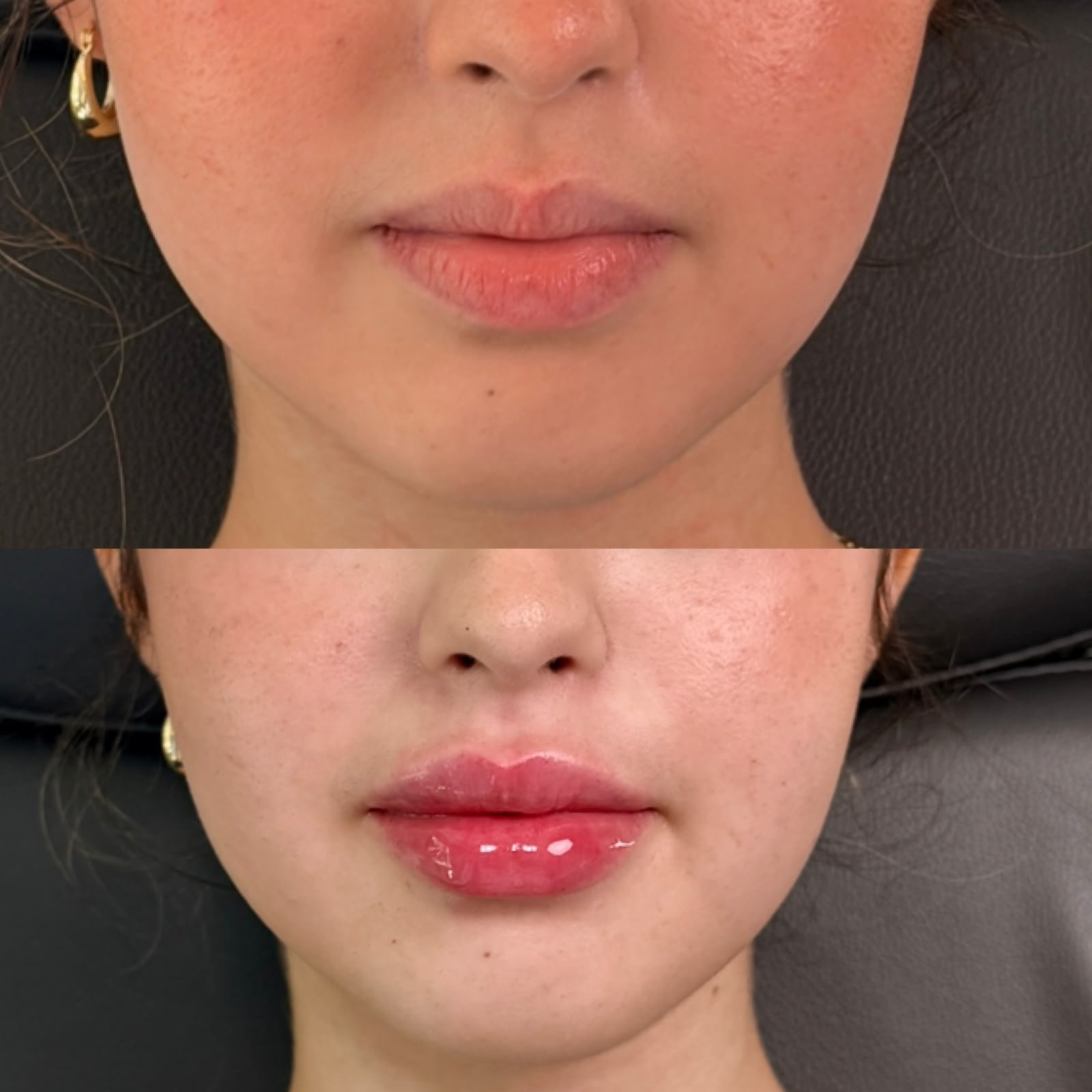 Casa Contour patient result 1