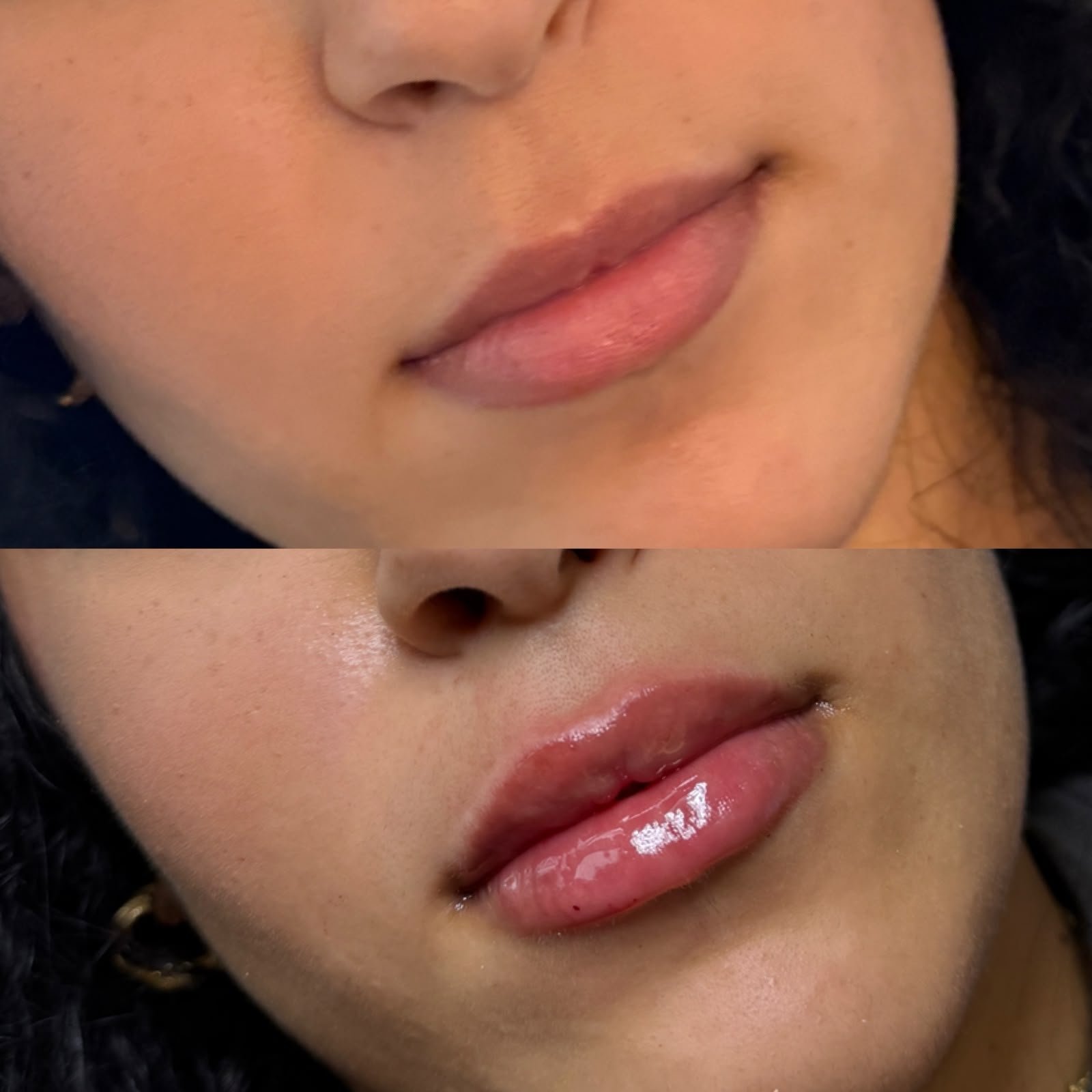 Casa Contour patient result 3
