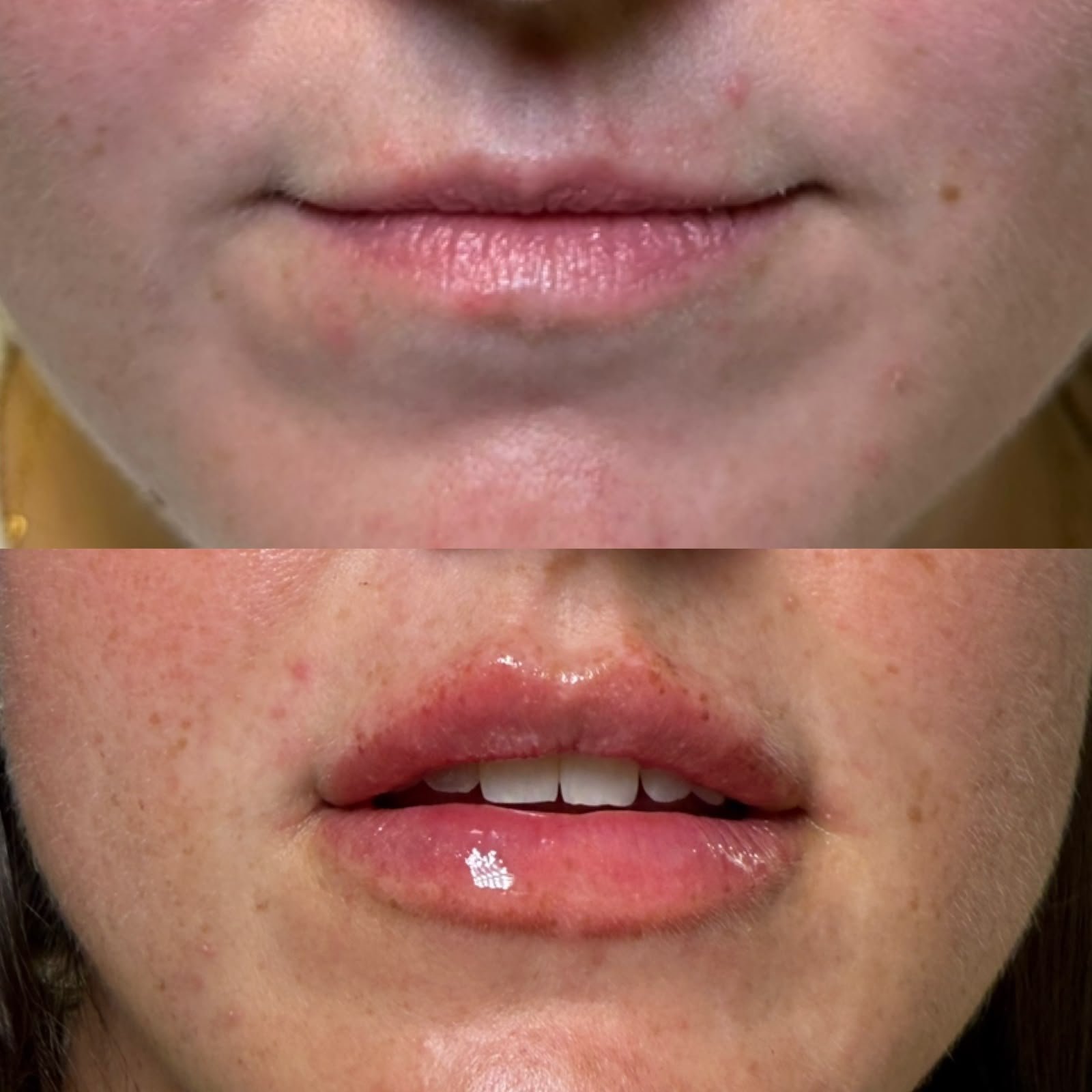 Casa Contour patient result 2