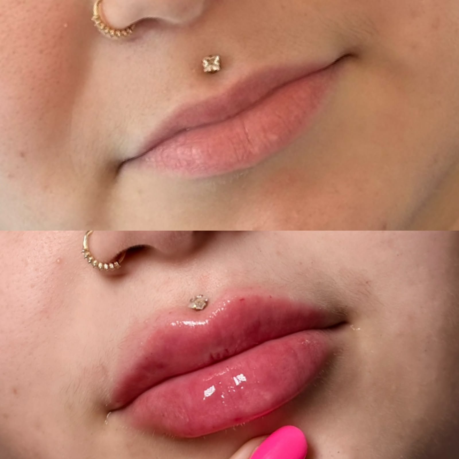 Casa Contour patient result 4
