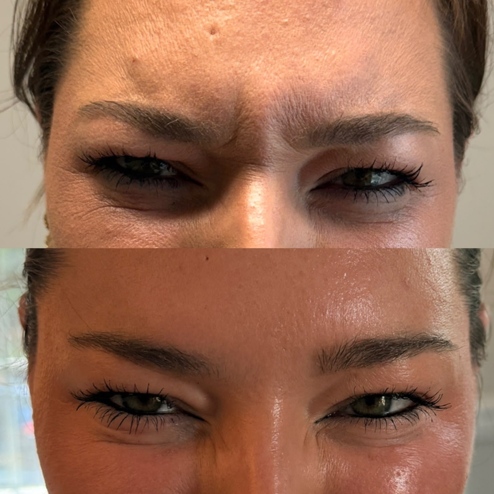 Casa Contour patient result 10