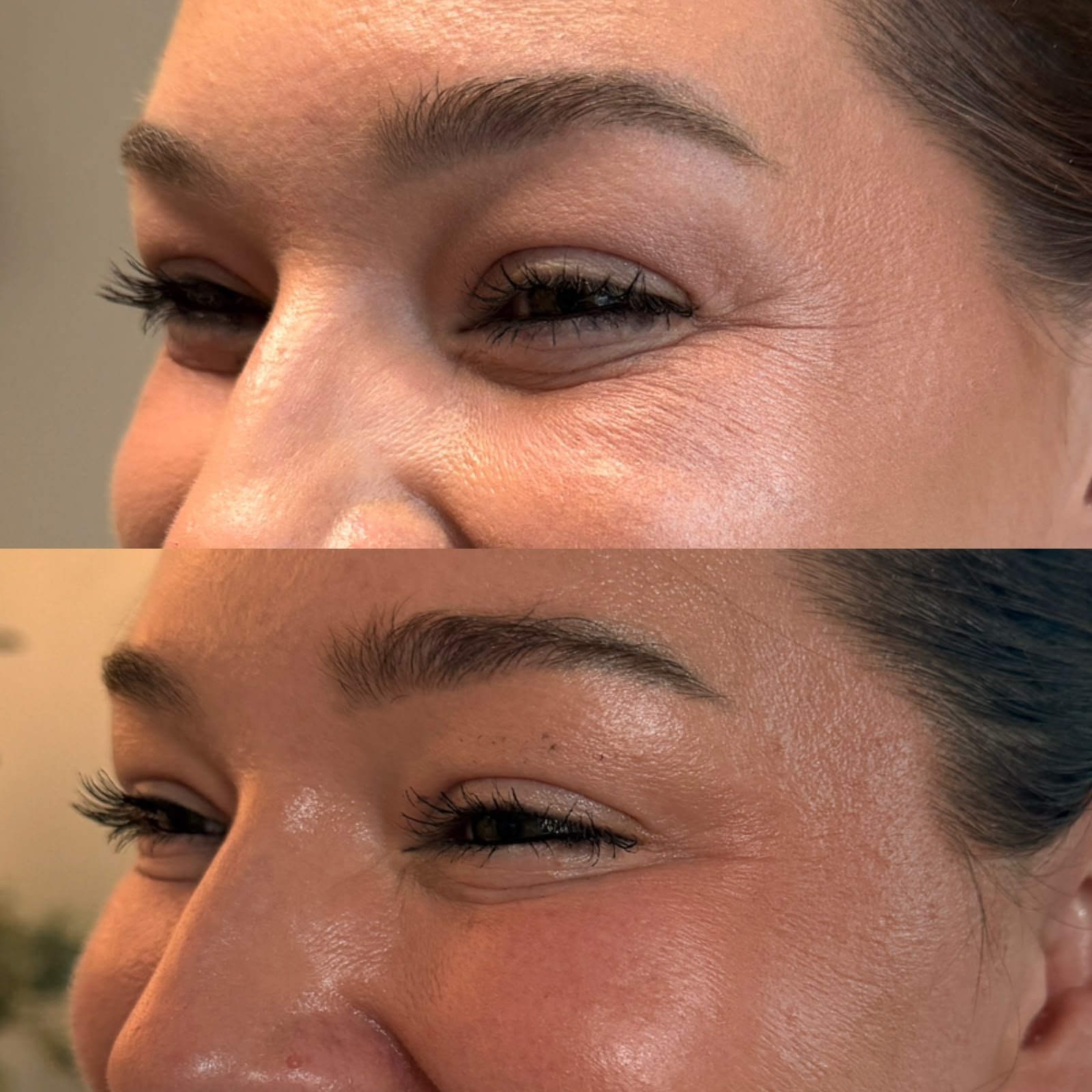 Casa Contour patient result 9
