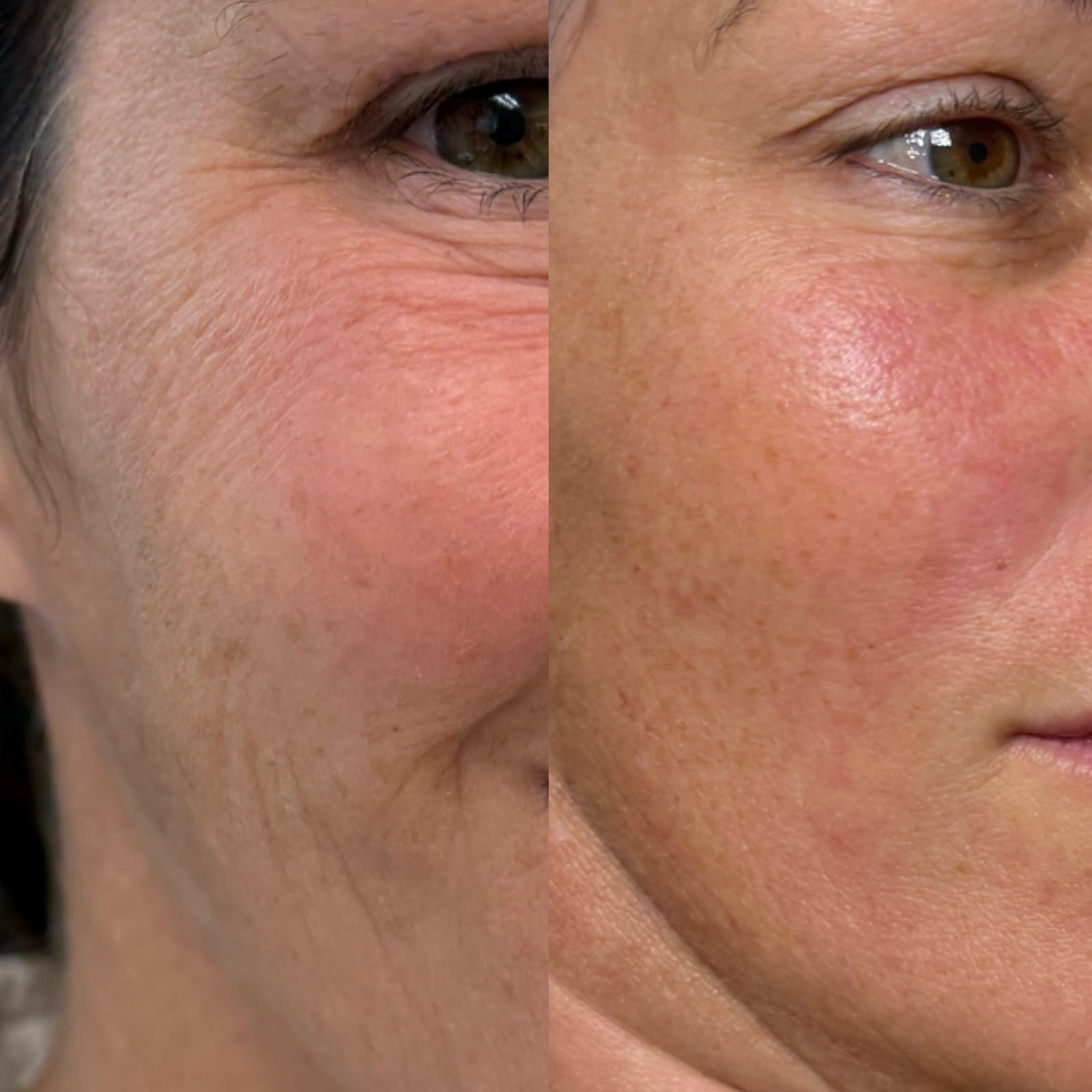 Casa Contour patient result 8