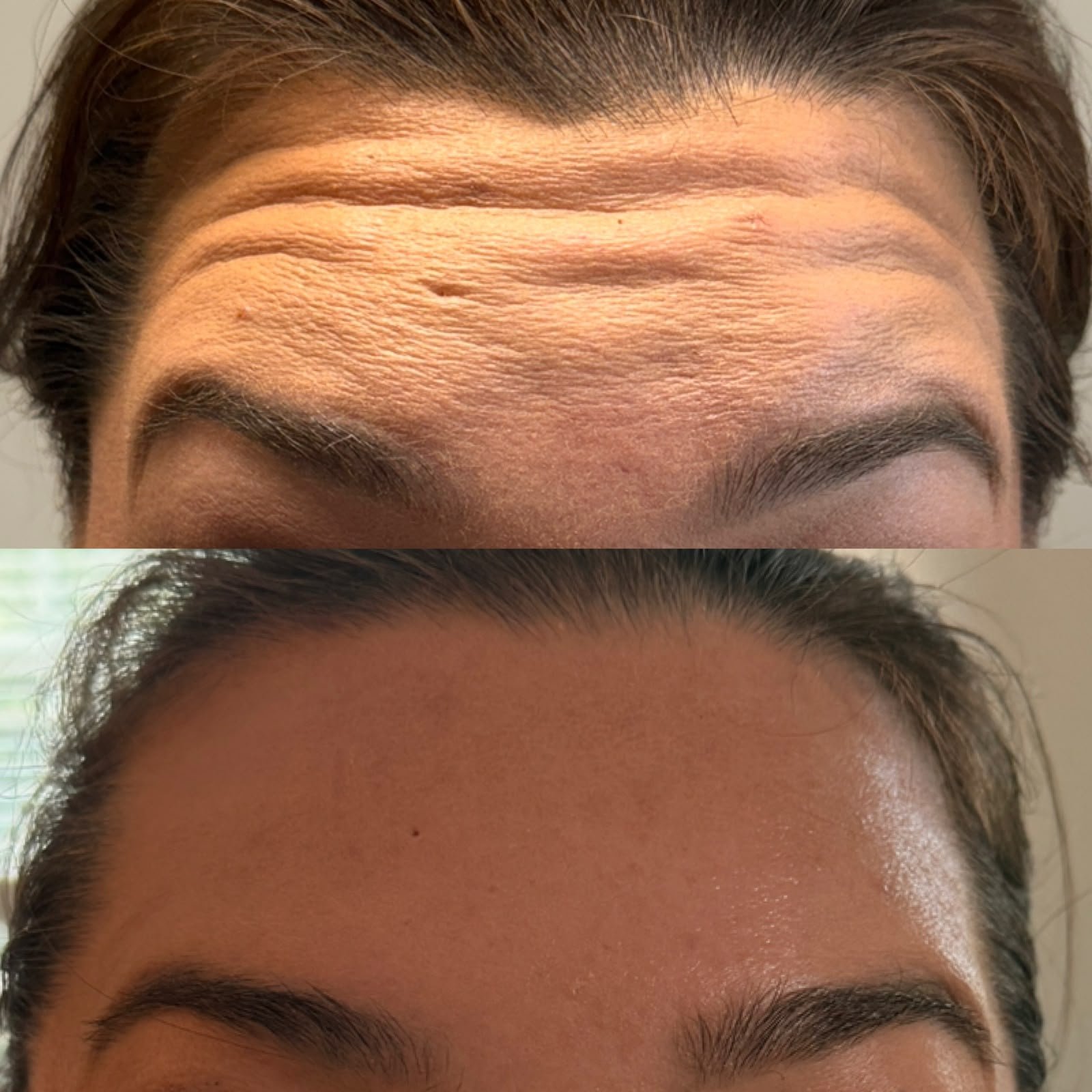 Casa Contour patient result 7