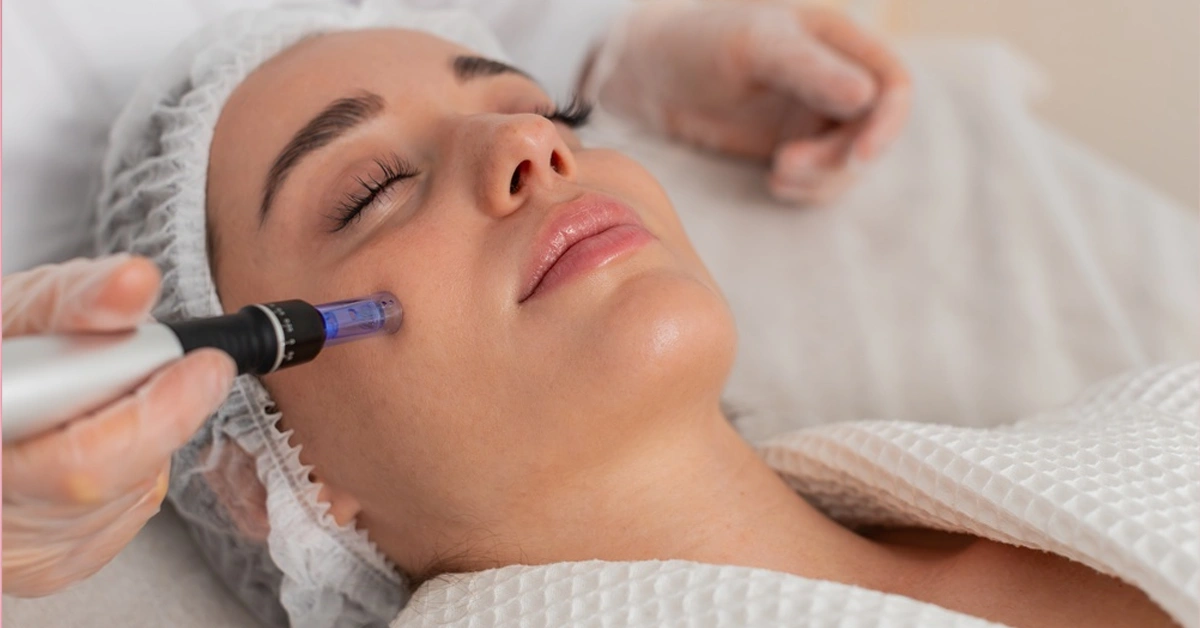 Microneedling treatment and skin renewal information