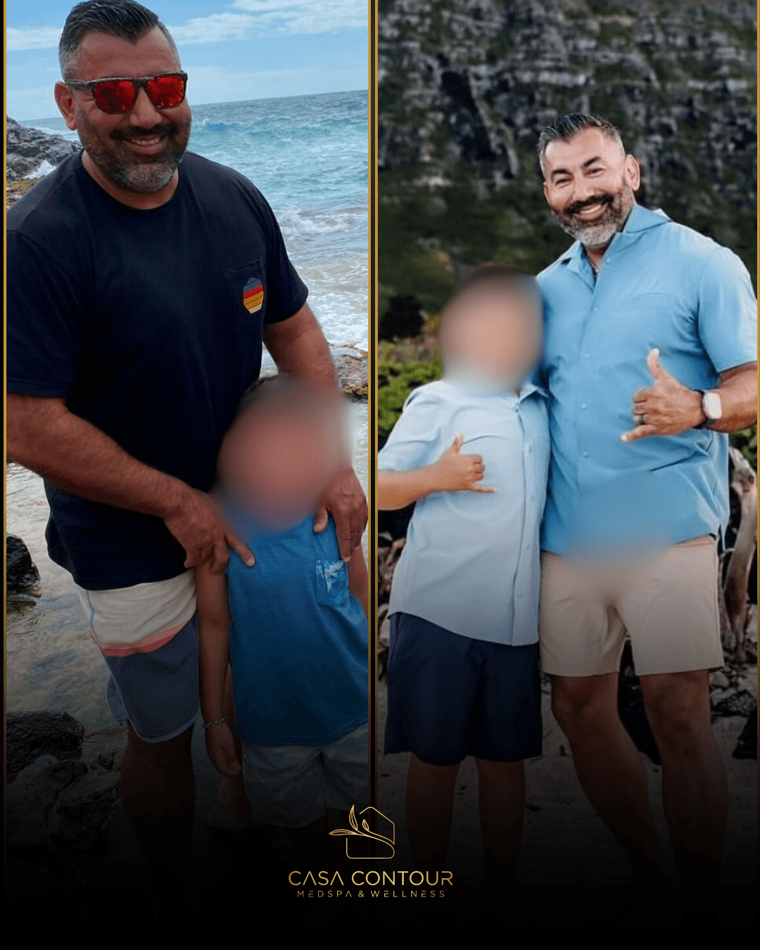 Casa Contour medical weight management patient journey