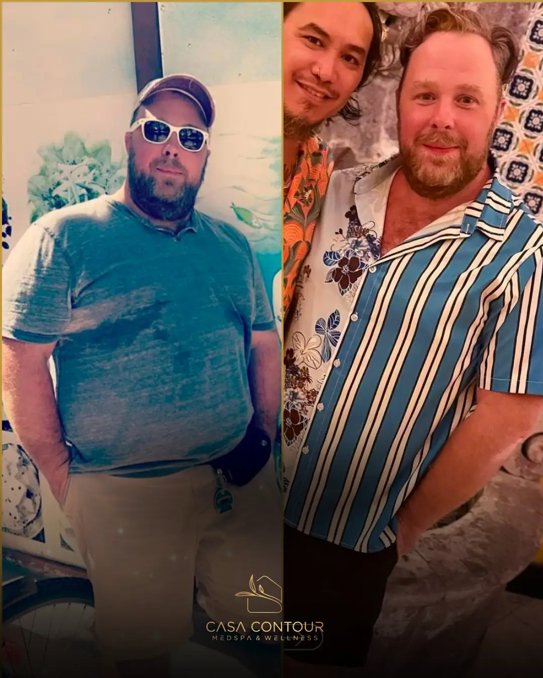 Casa Contour medical weight management patient journey