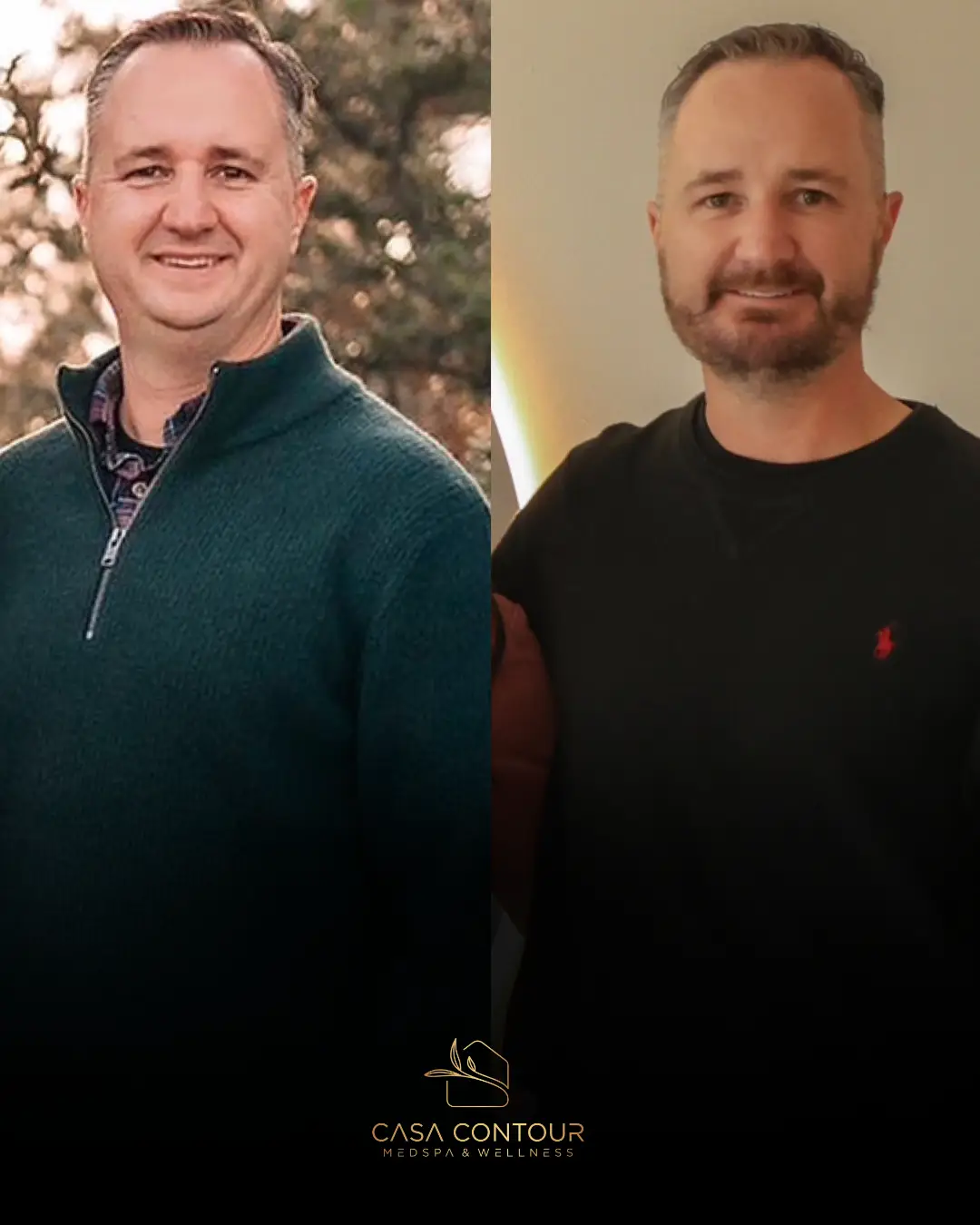 Casa Contour medical weight loss patient journey
