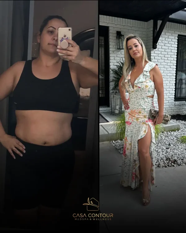 Weight Loss Treatment with - Tirzepatide 15mg