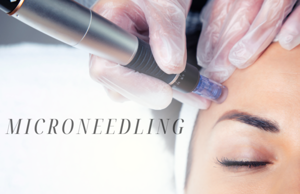 Microneedling