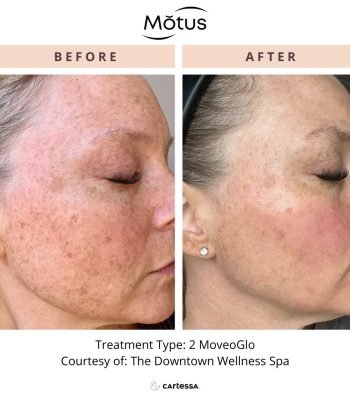 MotusAZ1173341149970