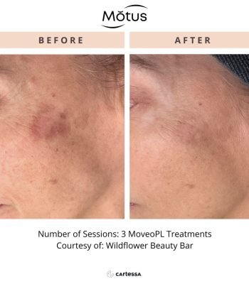 moveoPLWildflowerBeautyBar172980441413